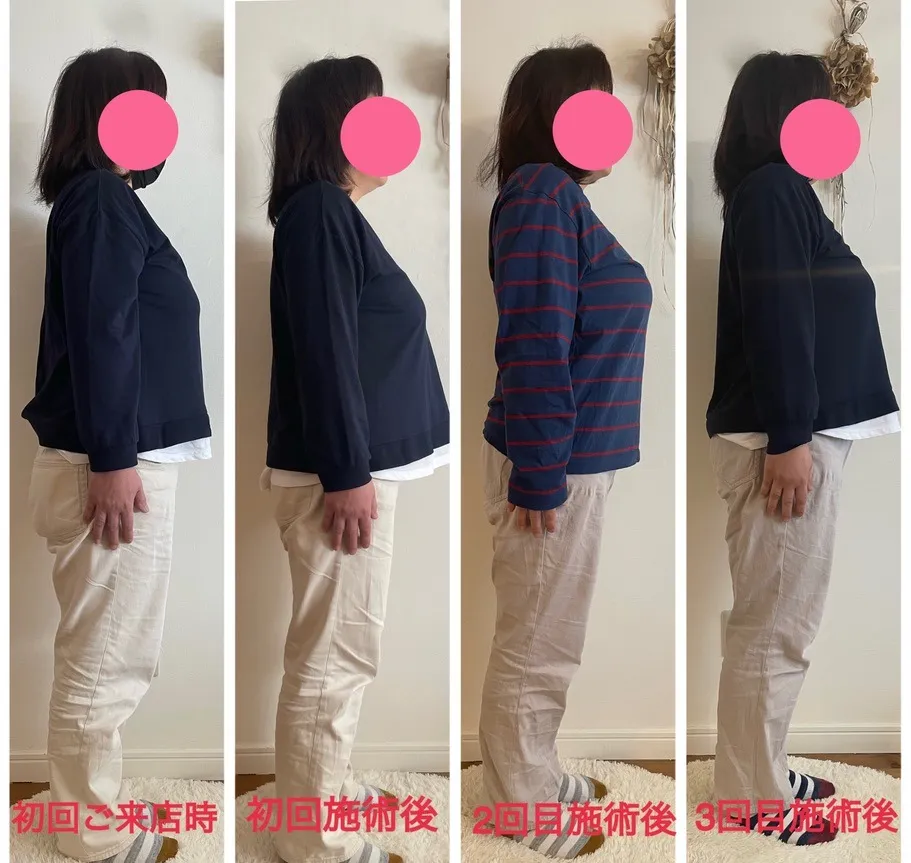 骨盤調整ビフォーアフター