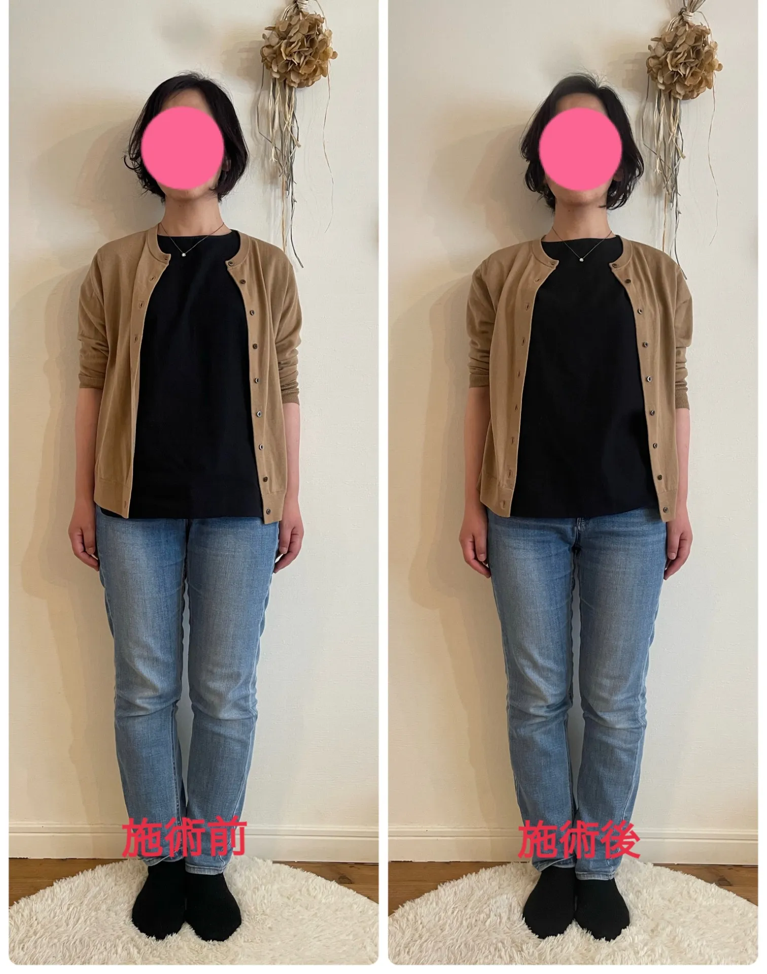 骨盤調整ビフォーアフター